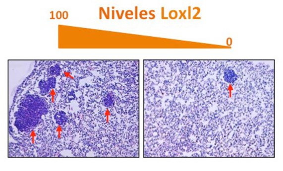 El papel de la proteína LOXL2 en la metástasis de cáncer de mama