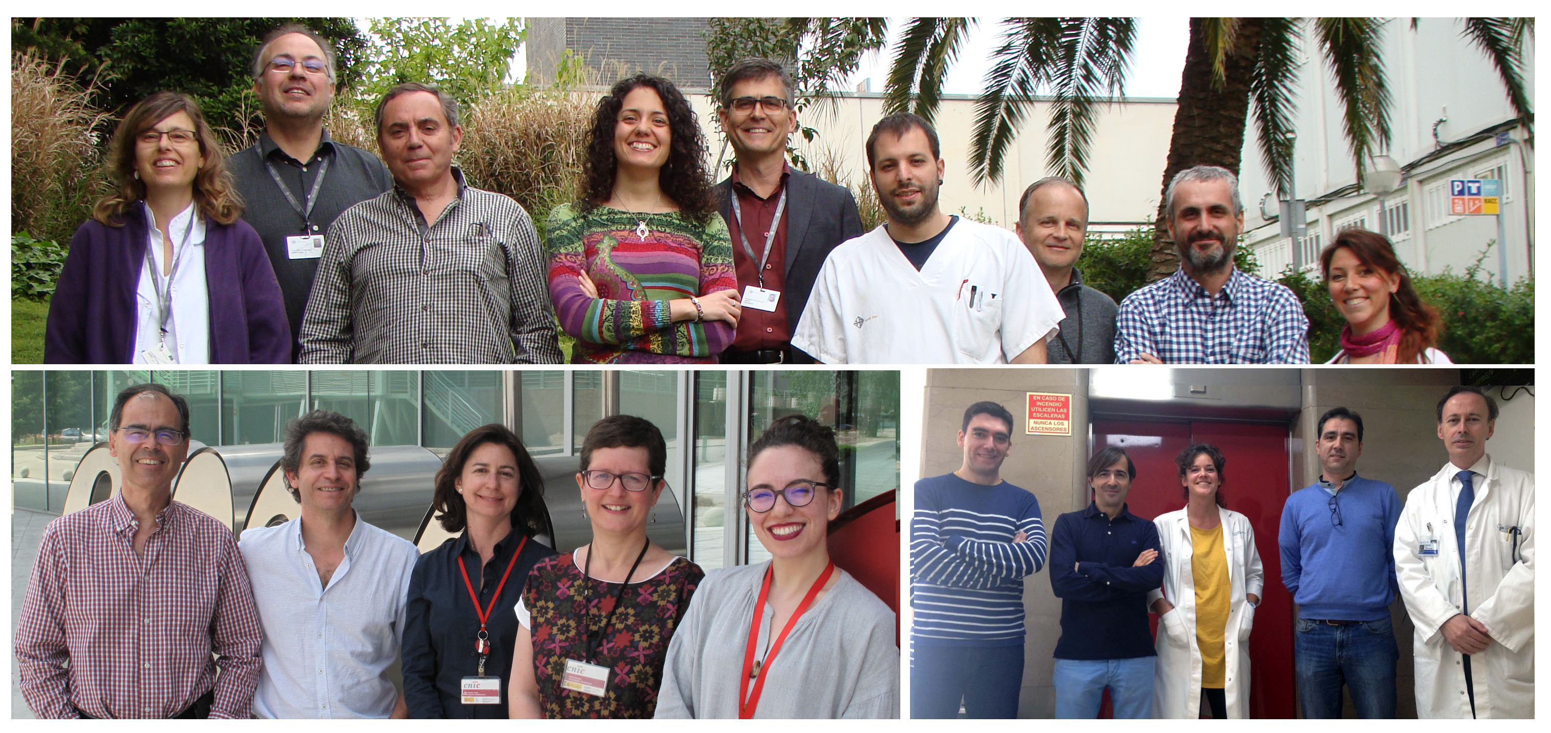 La oxidación de las lipoproteínas que transportan el colesterol ‘bueno’, un posible biomarcador de Aneurisma aórtico abdominal