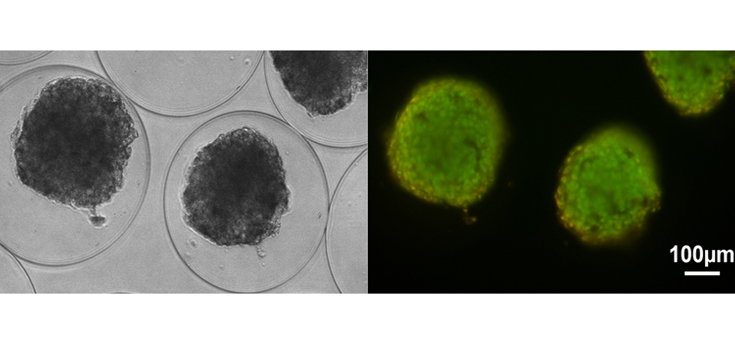 Un nuevo sistema para el tratamiento de la diabetes mellitus tipo 1
