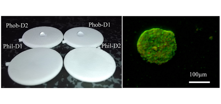 Los dispositivos de encapsulación celular con tecnología 3D, nueva vía para el tratamiento de la diabetes mellitus tipo 1