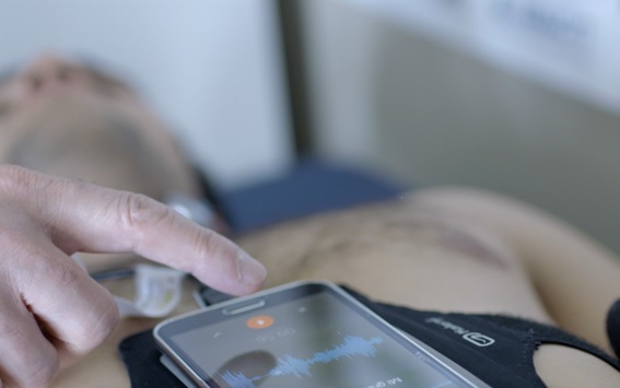 Un teléfono inteligente para detectar la apnea del sueño en casa