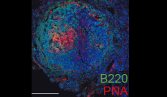 Identifican una nueva diana diagnóstica y terapéutica para la enfermedad cardiovascular
