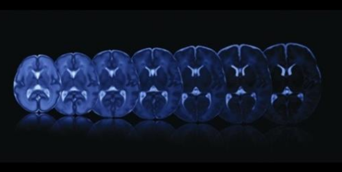 Nuevas técnicas para el estudio de la maduración del cerebro durante el embarazo