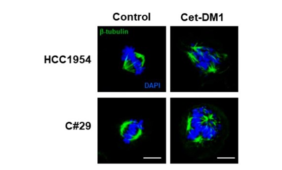 Identificada una nueva diana para tratamiento de cáncer de mama HER2 positivo con resistencia a T-DM1