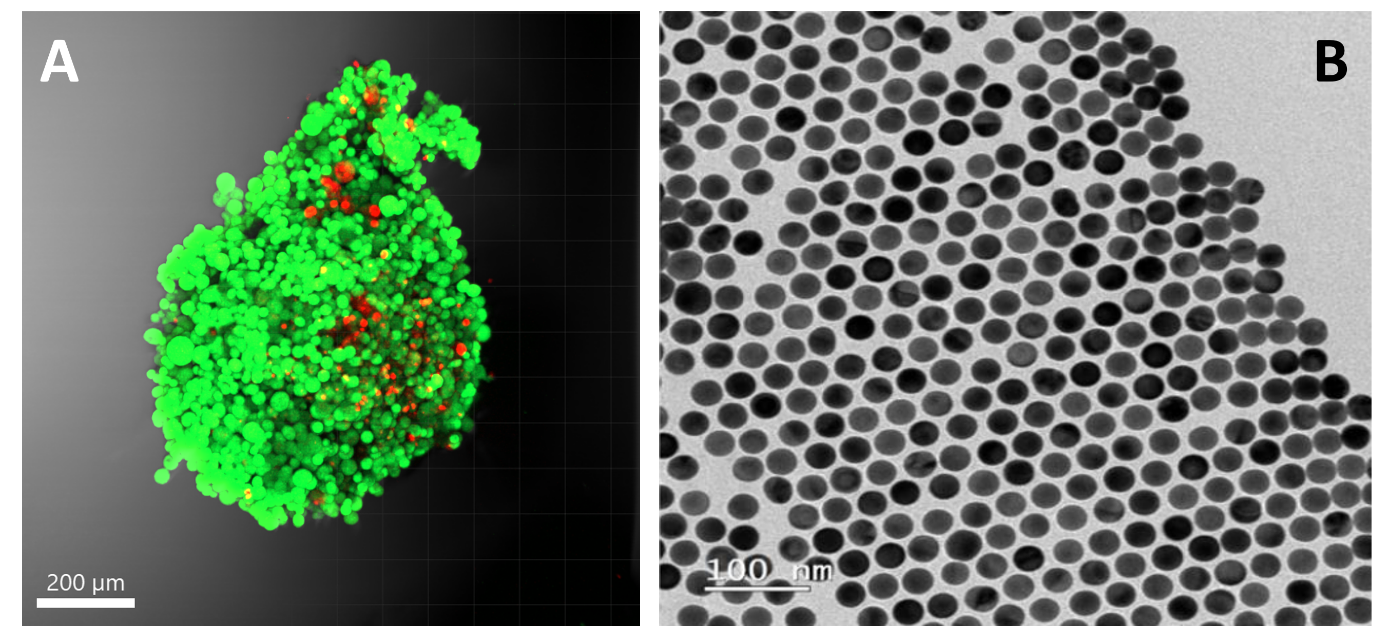Un estudio realizado utilizando la tecnología SERS revela un nuevo tipo de interacción entre las células tumorales y su entorno