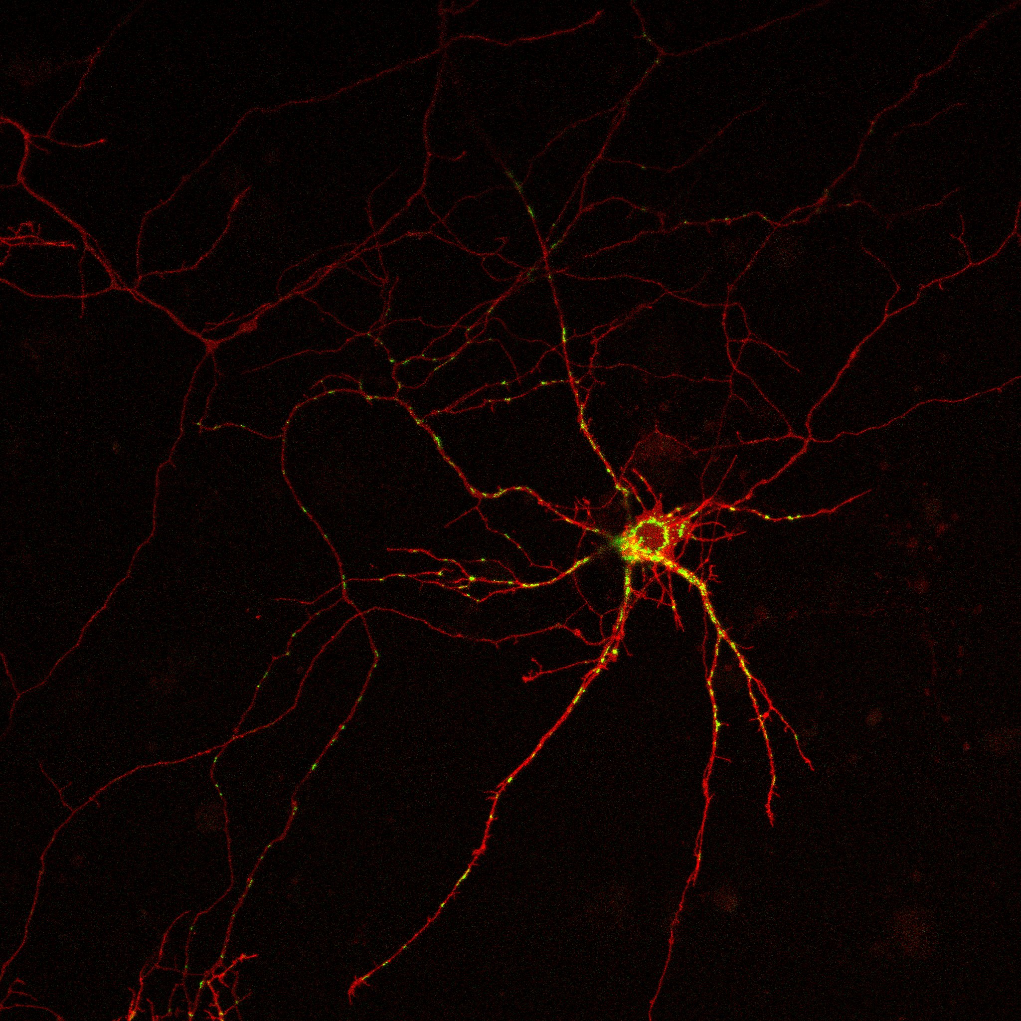 Descubierto un mecanismo molecular relacionado con la muerte de las neuronas