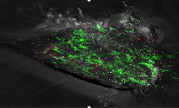 Deleciones en el ADN mitocondrial predicen el Parkinson antes de la aparición de los síntomas Deleciones en el ADN mitocondrial predicen el Parkinson antes de la aparición de los síntomas