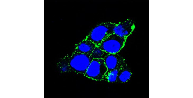 Desarrollan una nueva terapia dirigida al cáncer de pancreas