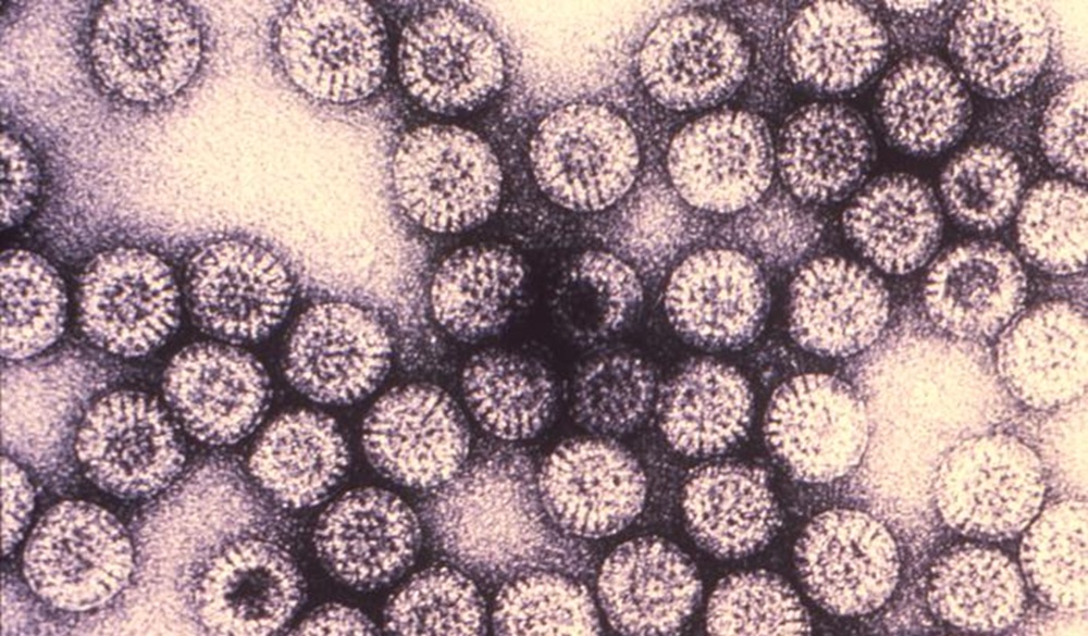 Analizan la diversidad genética del rotavirus y los factores asociados a la hospitalización infantil