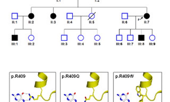 Asocian el gen EGR2 con la enfermedad de Charcot-Marie-Tooth axonal Asocian el gen EGR2 con la enfermedad de Charcot-Marie-Tooth axonal