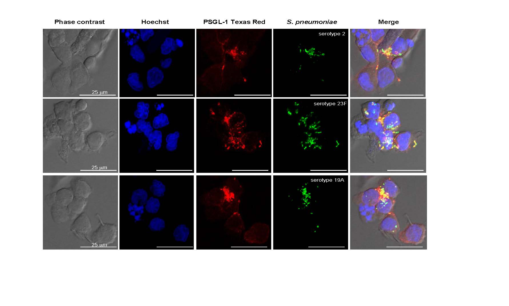 Identificado un nuevo receptor del sistema inmune frente a la infección neumocócica invasiva