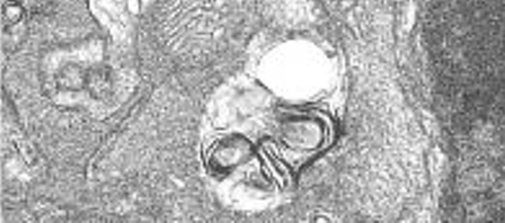 La autofagia resuelve la inflamación retiniana causada por el déficit en IGF-1 en el ratón-