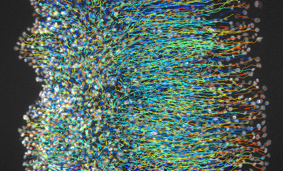 Las células se mueven en grupo hacia tejidos rígidos Las células se mueven en grupo hacia tejidos rígidos