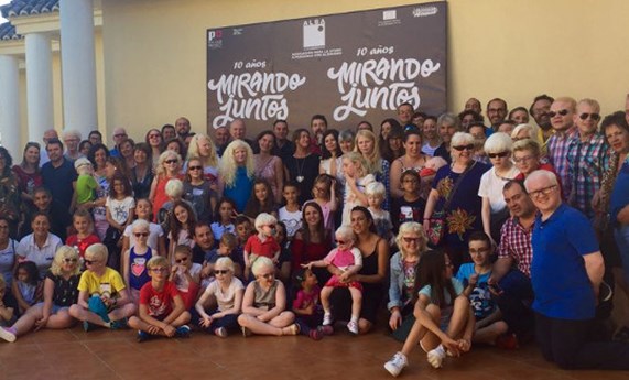 La Asociación ALBA de ayuda a personas con albinismo celebra su décimo aniversario La Asociación ALBA de ayuda a personas con albinismo celebra su décimo aniversario