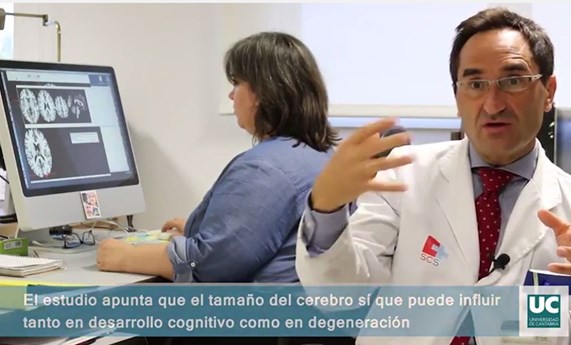 Identificados nuevos genes asociados al volumen del cerebro humano Identificados nuevos genes asociados al volumen del cerebro humano