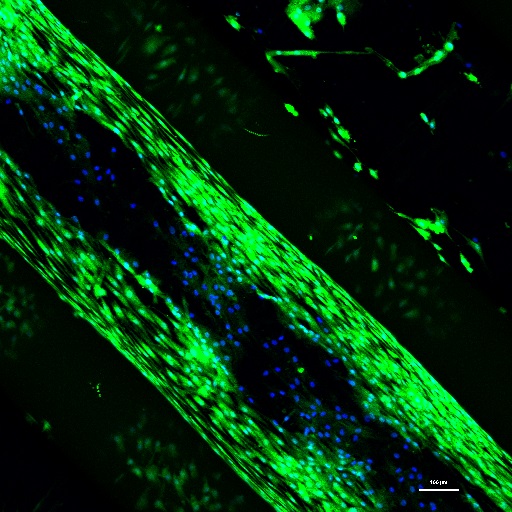 Desarrollan sistemas de bioimpresión 3D y biotintas para la regeneración de cartílago y hueso