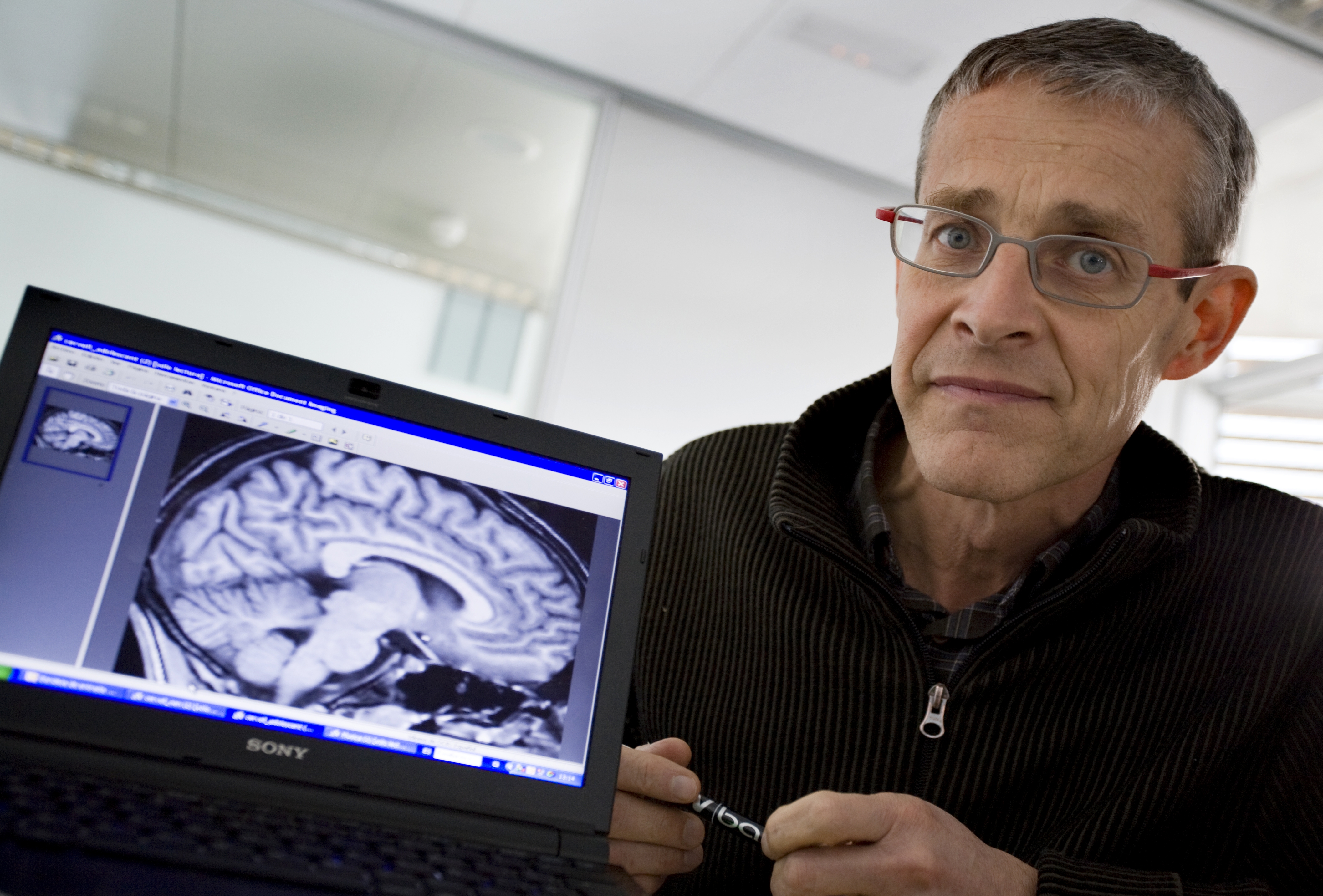 La contaminación procedente del tráfico disminuye la capacidad de atención de los niños a corto plazo