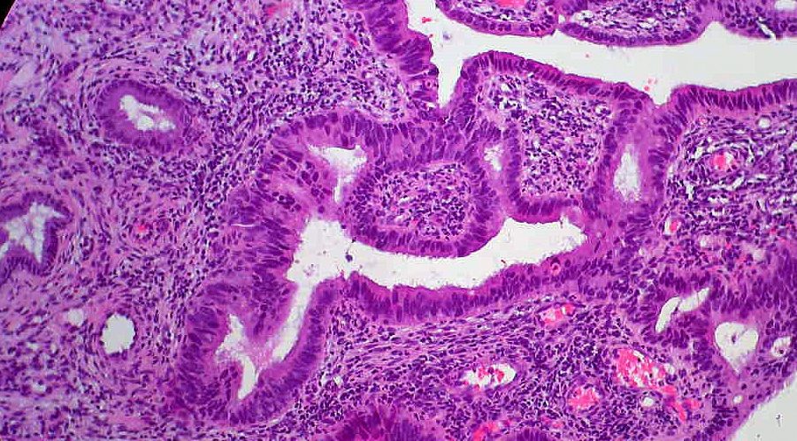 Primera reunión del Programa de Cáncer de Mama del CIBERONC