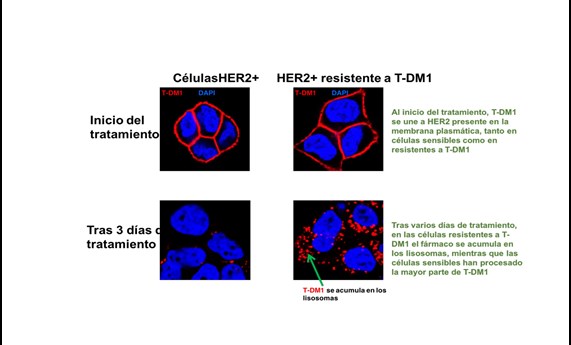 Describen un mecanismo de resistencia al fármaco contra el cáncer de mama trastuzumab-emtansina
