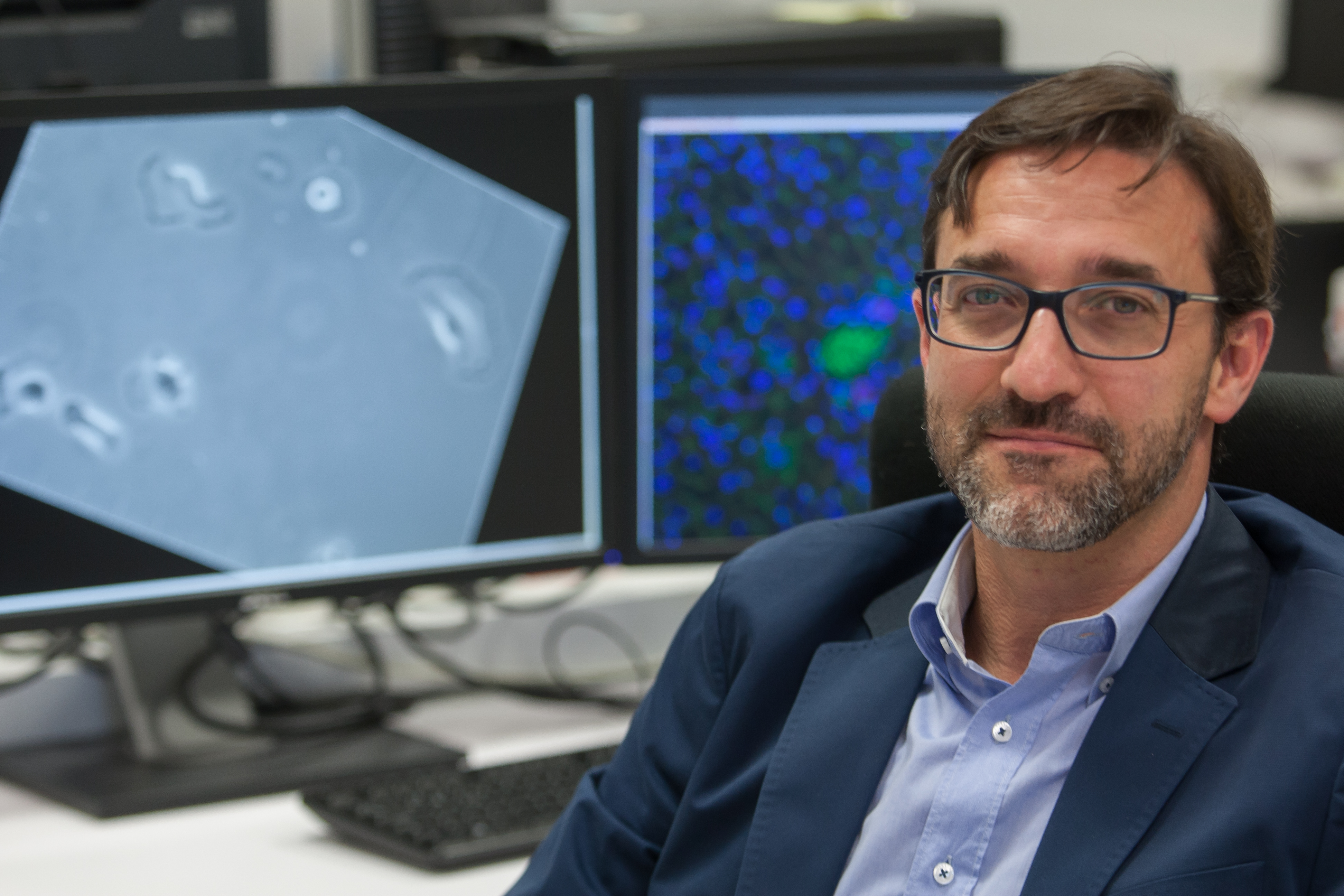 Seguimiento automático de las células para conocer las alteraciones implicadas en el cáncer